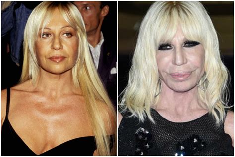 chirurgia di donatella versace|donatella versace cosmetics.